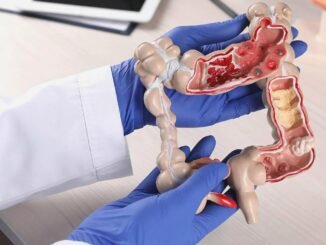 40 Yaşında Kolon Kanseri İçin Genetik Uyarı - Kadın Girişim