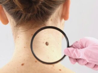 Dermatolog Uyarısı: Gözlenen Değişiklikleri Ciddiye Alın - Kadın Girişim