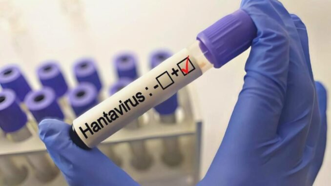 Hantavirüs Uyarısı: Grip Belirtileriyle Karışmasın - Kadın Girişim